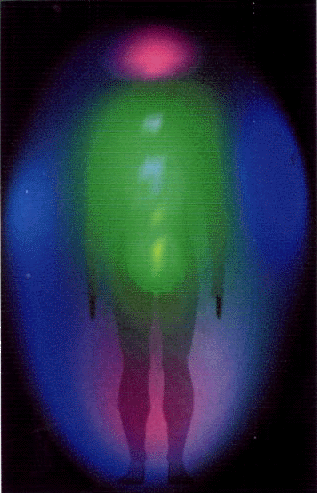 Subject 1 - after 
