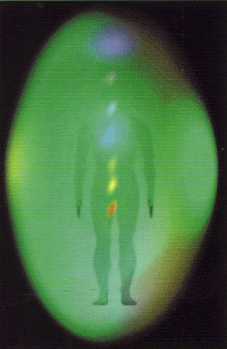 Subject 1 - baseline